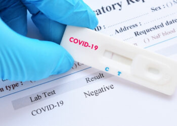 Gobierno municipal atiende Covid-19 con más pruebas gratuitas