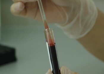 Concientizan a la población en el marco del Día Mundial de la Lucha contra el Sida