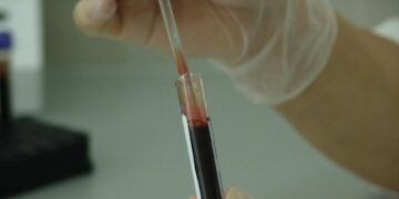 Concientizan a la población en el marco del Día Mundial de la Lucha contra el Sida