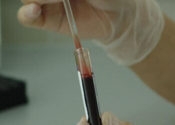 Playa del Carmen, primer lugar en contagios de VIH en América Latina; jóvenes deben cuidarse