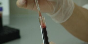 Playa del Carmen, primer lugar en contagios de VIH en América Latina; jóvenes deben cuidarse